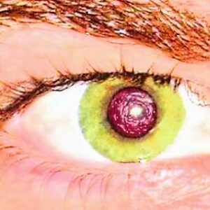 Universal eye